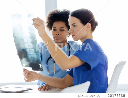 doctors with x-ray image of spine at hospital doctors with x-ray image of spine at hospital 20172386