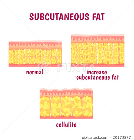 leather sectional layer of subcutaneous fat leather sectional layer of subcutaneous fat 20173877