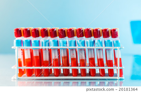 test tubes with blood on a tray test tubes with blood on a tray 20181364
