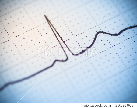 Close up of an electrocardiogram. 20185063