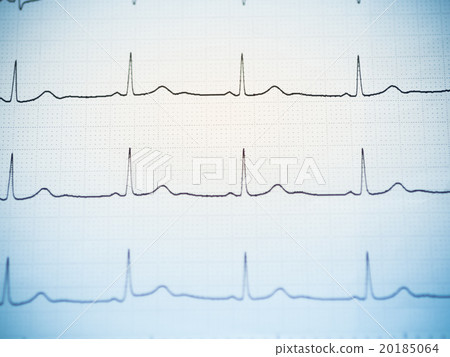 Close up of an electrocardiogram. 20185064