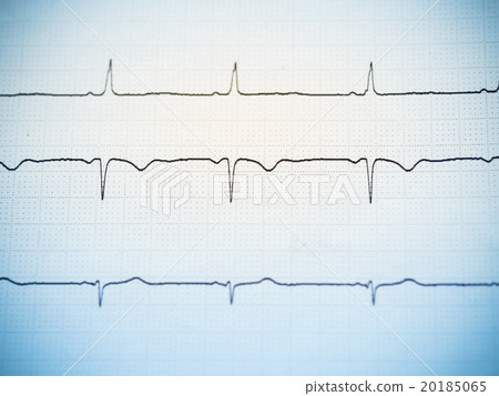 Close up of an electrocardiogram. 20185065
