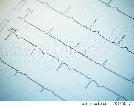 Close up of an electrocardiogram. Close up of an electrocardiogram. 20185067