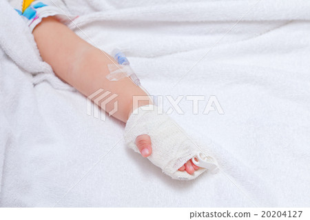 closeup of a patient hand with disposable infusion 20204127