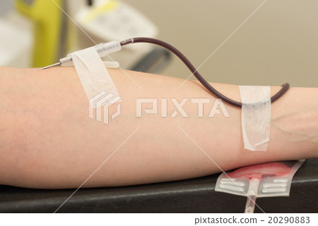 Donor in an armchair donates blood,, close-up 20290883