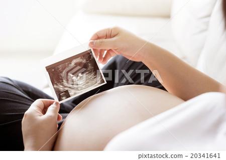 Pregnant woman with ultrasound scan picture 20341641