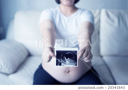 Pregnant woman with ultrasound scan picture 20341643