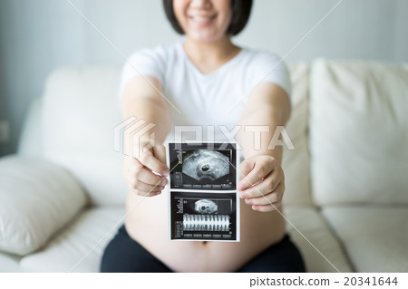 Pregnant woman with ultrasound scan picture 20341644