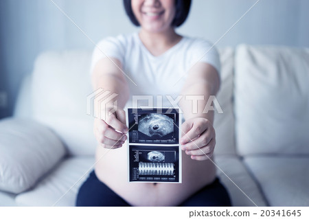 Pregnant woman with ultrasound scan picture 20341645
