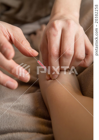 Acupuncture Acupuncture 20382258