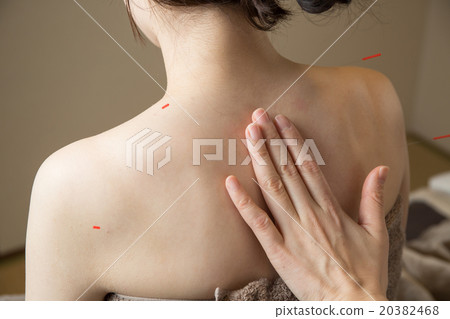 Acupuncture Acupuncture 20382468