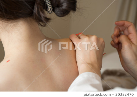 Acupuncture Acupuncture 20382470