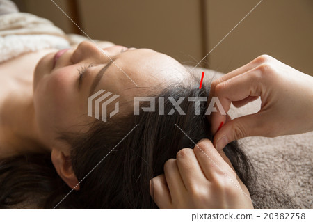 Acupuncture 20382758