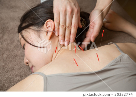 Acupuncture 20382774