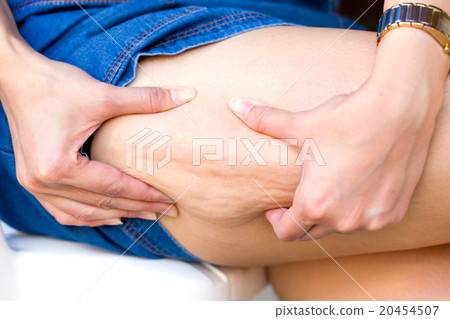 Close up cellulite leg skin woman buttocks. 20454507