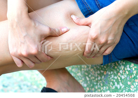 Close up cellulite leg skin woman buttocks. 20454508