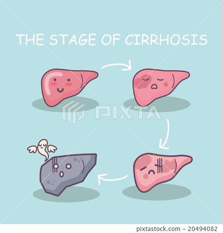 Health liver vs cirrhosis liver Health liver vs cirrhosis liver 20494082