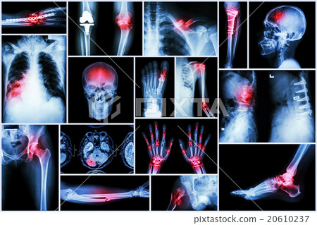 Collection X-ray multiple disease 20610237