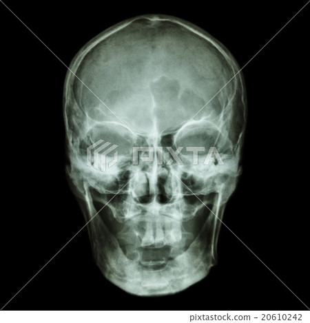 X-ray skull (Asian) X-ray skull (Asian) 20610242