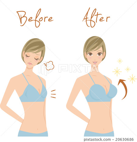 breast enhancement breast enhancement 20630686
