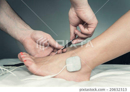 Placing TENS electrodes on foot Placing TENS electrodes on foot 20632313