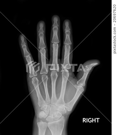 X-Ray Hand. 20697620
