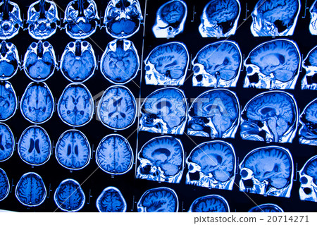 Stock Photo: research in medicine. CT scan of the patient.