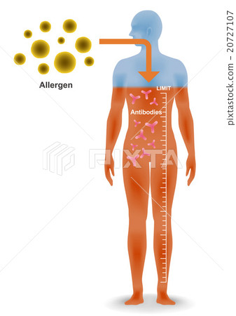 過敏發展的機制 過敏發展的機制 20727107