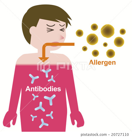 Mechanism of allergy development Mechanism of allergy development 20727110