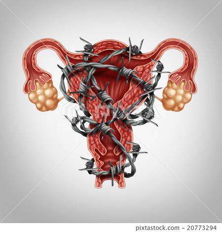 Uterus Pain Uterus Pain 20773294