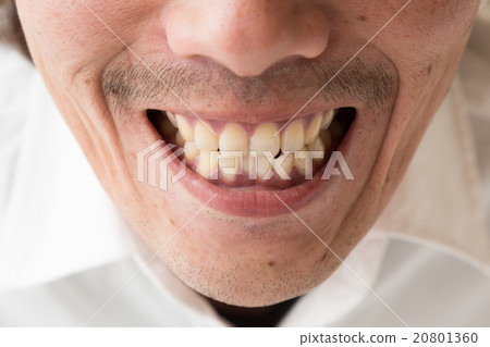 Men's teeth 20801360
