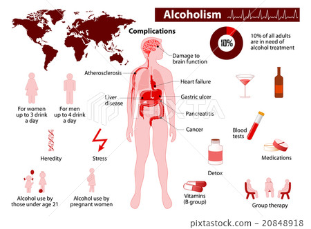 Alcoholism infographic 20848918
