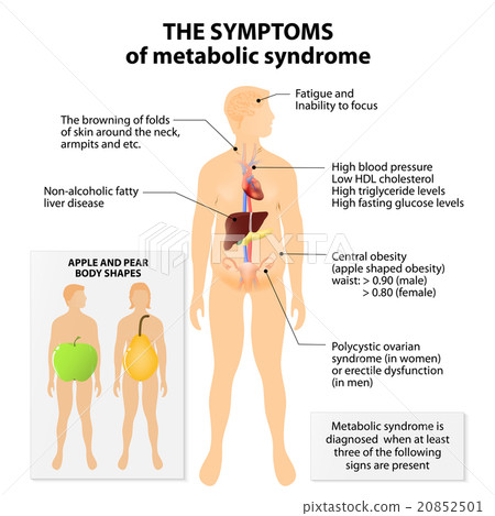 Metabolic syndrome 20852501