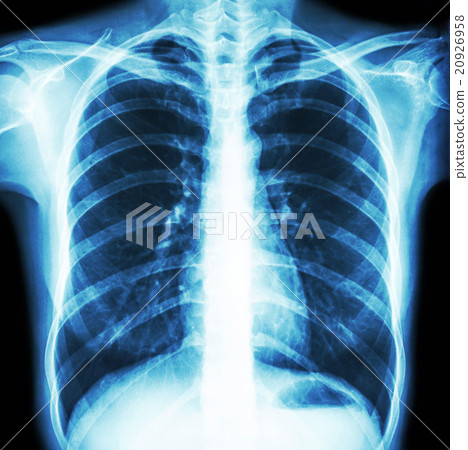 normal human's chest normal human's chest 20926958