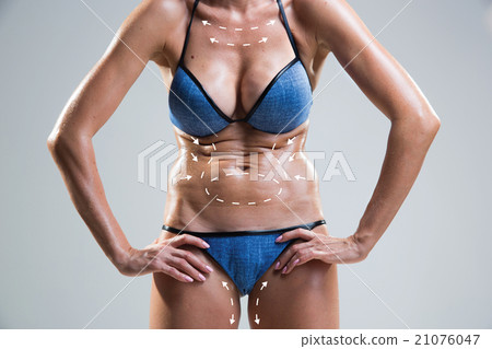 Body correction with the help of plastic surgery 21076047