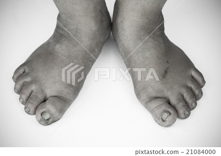 monochrome or back and white of dirty foot monochrome or back and white of dirty foot 21084000