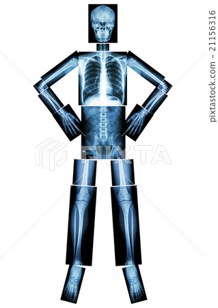 Human bone stand and akimbo  21156316