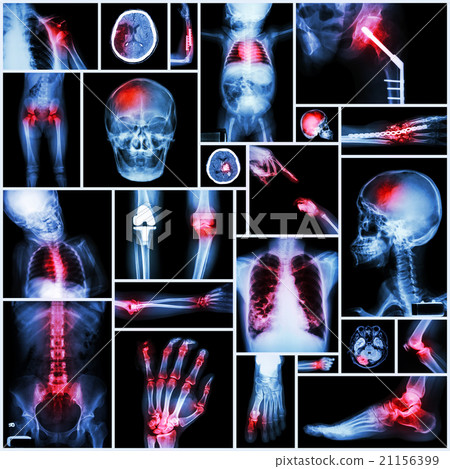 Collection of X-ray multiple part of human Collection of X-ray multiple part of human 21156399