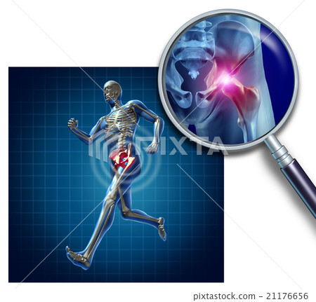 Sports Hip Injury Sports Hip Injury 21176656