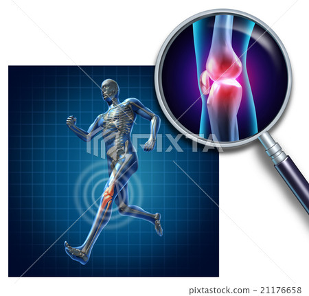 Sports Knee Injury Sports Knee Injury 21176658