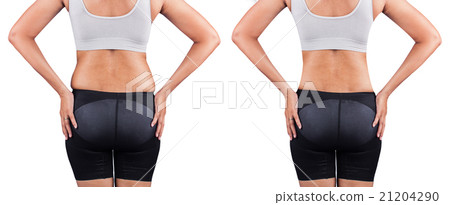 fat women from rear,before and after weight loss 21204290