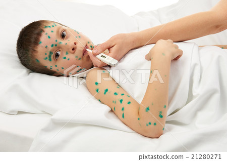 sick child in bed has the virus on skin sick child in bed has the virus on skin 21280271