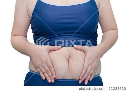 Asian woman in swim suit showing her stretch marks Asian woman in swim suit showing her stretch marks 21282620