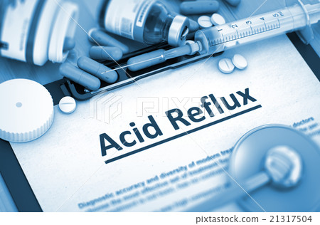 Acid Reflux Diagnosis. Medical Concept. 3D Render. 21317504