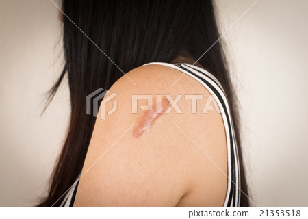 Skin lesions from allergies. 21353518