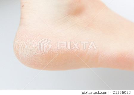 足部護理 21356053