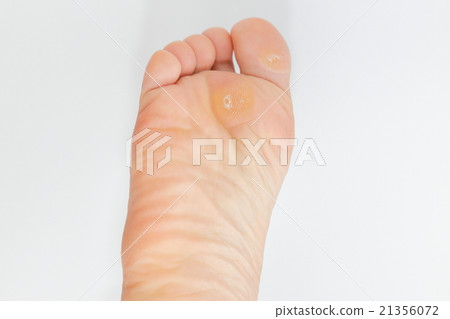 足部護理 21356072