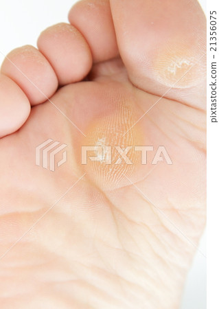 足部護理 足部護理 21356075