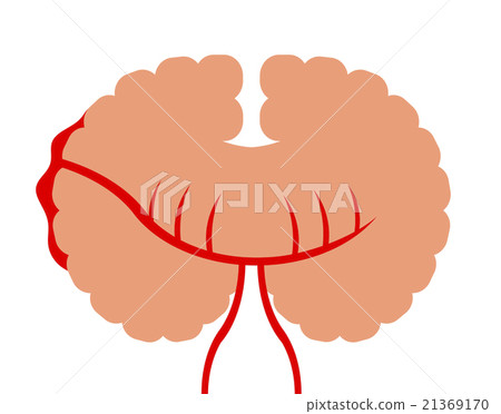 蛛網膜下腔出血 21369170