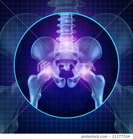 Back Joint Pain 21377104